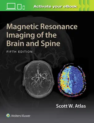 Imagistica prin rezonanță magnetică a creierului și a coloanei vertebrale - Magnetic Resonance Imaging of the Brain and Spine