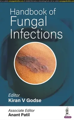 Manual de infecții fungice - Handbook of Fungal Infections