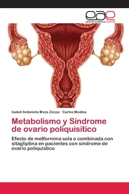 Metabolismul și Sindromul de ovar poliquisitico - Metabolismo y Sndrome de ovario poliquisitico