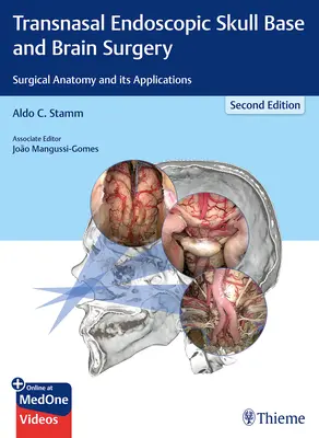 Chirurgia transnasală endoscopică a bazei craniului și a creierului: Anatomia chirurgicală și aplicațiile sale - Transnasal Endoscopic Skull Base and Brain Surgery: Surgical Anatomy and Its Applications
