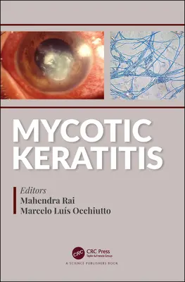 Cheratita micotică - Mycotic Keratitis