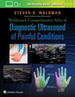 Atlasul cuprinzător al lui Waldman de diagnostic ecografic al afecțiunilor dureroase - Waldman's Comprehensive Atlas of Diagnostic Ultrasound of Painful Conditions