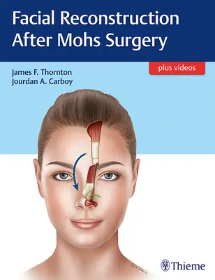 Reconstrucția facială după chirurgia Mohs - Facial Reconstruction After Mohs Surgery