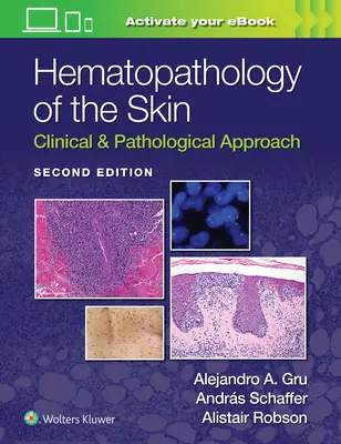Hematopatologia pielii: Abordare clinică și patologică - Hematopathology of the Skin: Clinical & Pathological Approach