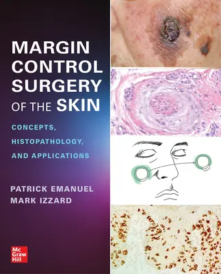 Chirurgia controlului marginilor pielii: Concepte, histopatologie și aplicații - Margin Control Surgery of the Skin: Concepts, Histopathology, and Applications
