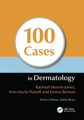 100 de cazuri în dermatologie - 100 Cases in Dermatology