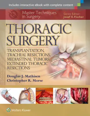 Tehnici magistrale în chirurgie: Chirurgie toracică: Transplant, rezecții traheale, tumori mediastinale, rezecții toracice extinse - Master Techniques in Surgery: Thoracic Surgery: Transplantation, Tracheal Resections, Mediastinal Tumors, Extended Thoracic Resections
