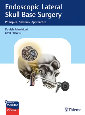 Chirurgia laterală endoscopică a bazei craniului: Principii, anatomie, abordări - Endoscopic Lateral Skull Base Surgery: Principles, Anatomy, Approaches