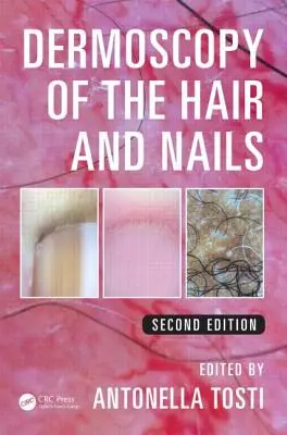 Dermoscopia părului și a unghiilor - Dermoscopy of the Hair and Nails