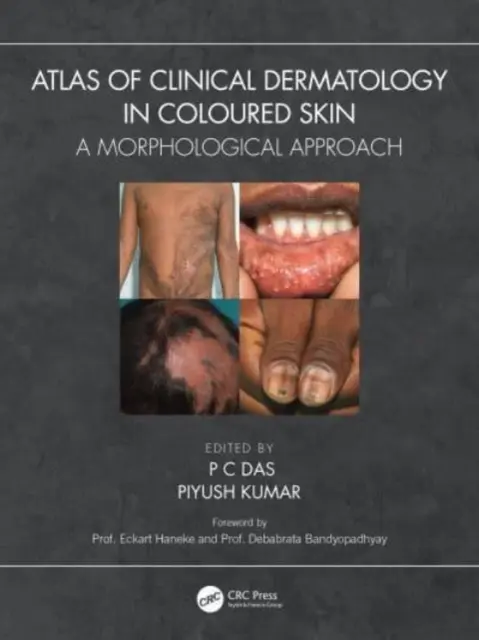 Atlas de dermatologie clinică în pielea colorată: A Morphological Approach - Atlas of Clinical Dermatology in Coloured Skin: A Morphological Approach