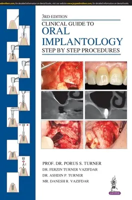 Ghid clinic de implantologie orală: Proceduri pas cu pas - Clinical Guide to Oral Implantology: Step by Step Procedures