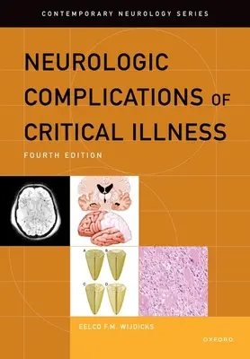 Complicațiile neurologice ale bolilor critice - Neurologic Complications of Critical Illness