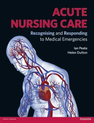 Asistență medicală acută: Recunoașterea și răspunsul la urgențele medicale - Acute Nursing Care: Recognising and Responding to Medical Emergencies