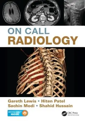 Radiologie de gardă - On Call Radiology