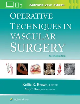 Tehnici operatorii în chirurgia vasculară - Operative Techniques in Vascular Surgery