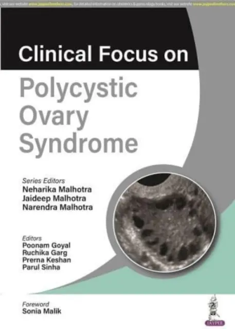 Accent clinic pe sindromul ovarelor polichistice - Clinical Focus on Polycystic Ovary Syndrome