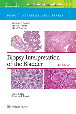 Interpretarea biopsiei vezicii urinare (Biopsy Interpretation of the Bladder) - Biopsy Interpretation of the Bladder