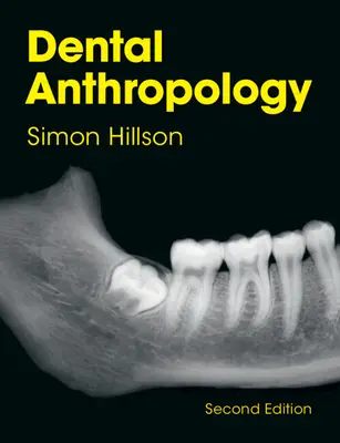 Dental Anthropology (Hillson Simon (University College London))