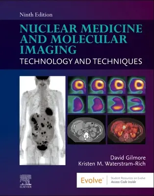Medicină nucleară și imagistică moleculară: Tehnologie și tehnici - Nuclear Medicine and Molecular Imaging: Technology and Techniques