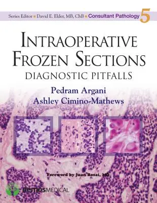 Secțiuni congelate intraoperatorii: Capcane diagnostice - Intraoperative Frozen Sections: Diagnostic Pitfalls