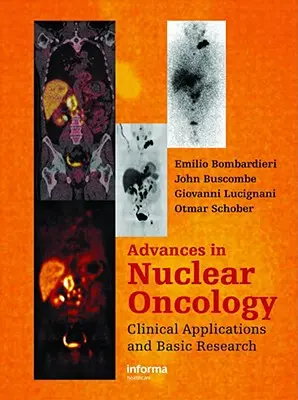 Advances in Nuclear Oncology:: Diagnostic și terapie - Advances in Nuclear Oncology:: Diagnosis and Therapy