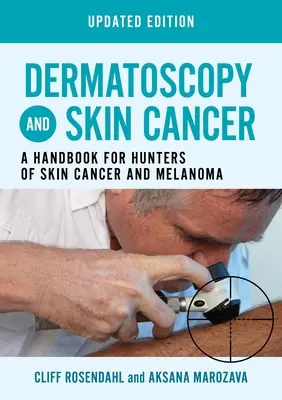 Dermatoscopia și cancerul de piele, ediție actualizată - Un manual pentru vânătorii de cancer de piele și melanom - Dermatoscopy and Skin Cancer, updated edition - A handbook for hunters of skin cancer and melanoma