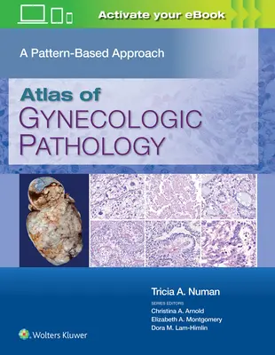 Atlas de patologie ginecologică: O abordare bazată pe modele - Atlas of Gynecologic Pathology: A Pattern-Based Approach