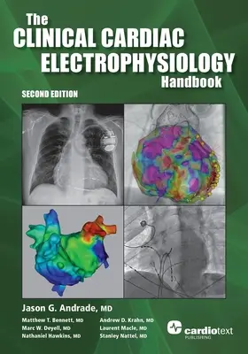 Manual de electrofiziologie cardiacă clinică, ediția a doua - The Clinical Cardiac Electrophysiology Handbook, Second Edition