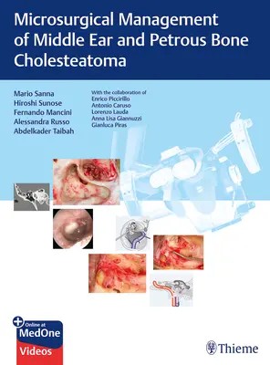 Managementul microchirurgical al colesteatomului urechii medii și al osului petros - Microsurgical Management of Middle Ear and Petrous Bone Cholesteatoma