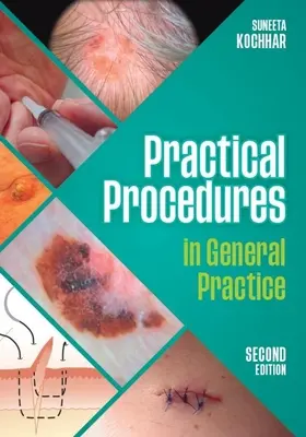 Proceduri practice în medicina generală, ediția a doua (Kochhar Suneeta (GP în East Sussex)) - Practical Procedures in General Practice, second edition (Kochhar Suneeta (GP in East Sussex))