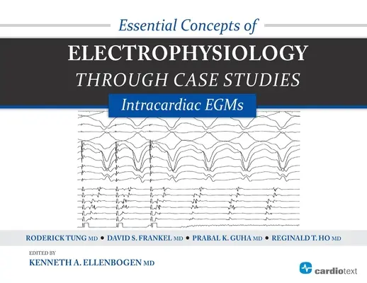 Concepte esențiale de electrofiziologie prin studii de caz: Intracardiac EGMs: Intracardiac EGMs - Essential Concepts of Electrophysiology Through Case Studies: Intracardiac EGMs: Intracardiac EGMs