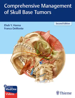 Managementul cuprinzător al tumorilor bazei craniului - Comprehensive Management of Skull Base Tumors