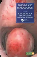 Fibroamele și reproducerea - Fibroids and Reproduction