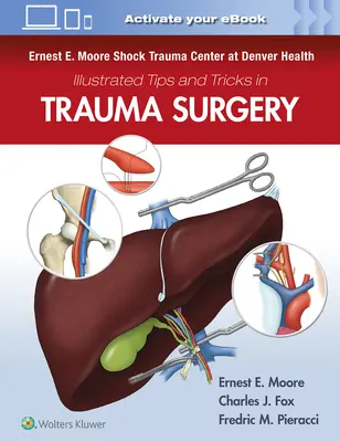 Ernest E. Moore Shock Trauma Center at Denver Health Sfaturi și trucuri ilustrate în chirurgia traumatologică - Ernest E. Moore Shock Trauma Center at Denver Health Illustrated Tips and Tricks in Trauma Surgery