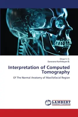 Interpretarea tomografiei computerizate - Interpretation of Computed Tomography