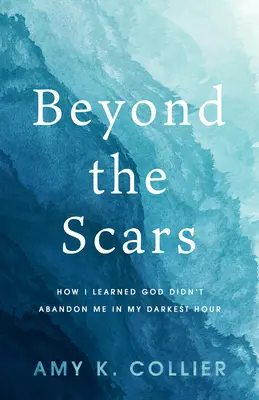 Dincolo de cicatrici: Cum am aflat că Dumnezeu nu m-a abandonat în cel mai întunecat moment al meu - Beyond the Scars: How I Learned God Didn't Abandon Me in My Darkest Hour