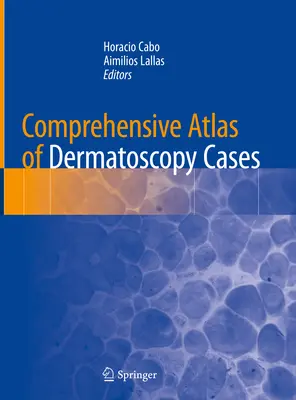 Atlas cuprinzător de cazuri de dermatoscopie - Comprehensive Atlas of Dermatoscopy Cases