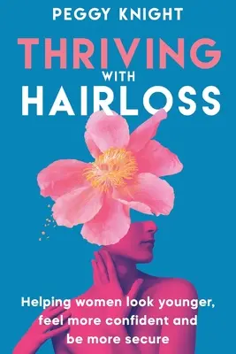 Trăind cu căderea părului: Ajutând femeile să arate mai tinere, să se simtă mai încrezătoare și să fie mai sigure - Thriving With Hairloss: Helping Women Look Younger, Feel More Confident and Be More Secure