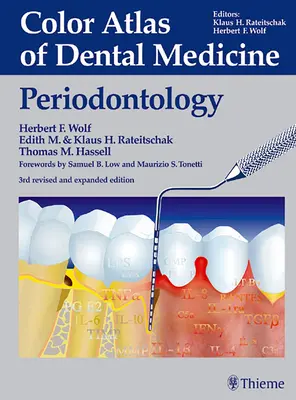 Atlas color de medicină dentară: Parodontologie - Color Atlas of Dental Medicine: Periodontology