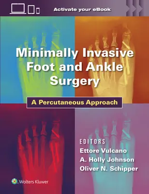 Chirurgia minim invazivă a piciorului și gleznei: O abordare percutanată - Minimally Invasive Foot and Ankle Surgery: A Percutaneous Approach