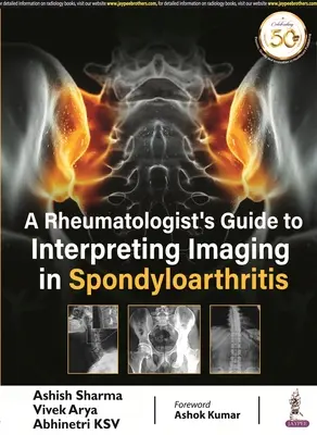 Ghidul reumatologului pentru interpretarea imagisticii în spondiloartrită - Rheumatologist's Guide to Interpreting Imaging in Spondyloarthritis