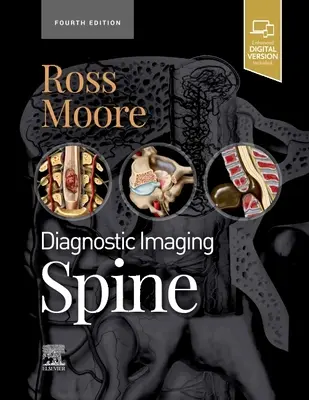 Diagnostic Imaging: Spine (Ross Jeffrey S. (Profesor de radiologie Mayo Clinic College Rochester Minnesota)) - Diagnostic Imaging: Spine (Ross Jeffrey S. (Professor of Radiology Mayo Clinic College Rochester Minnesota))