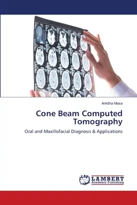Tomografie computerizată cu fascicul conic (Cone Beam Computed Tomography) - Cone Beam Computed Tomography