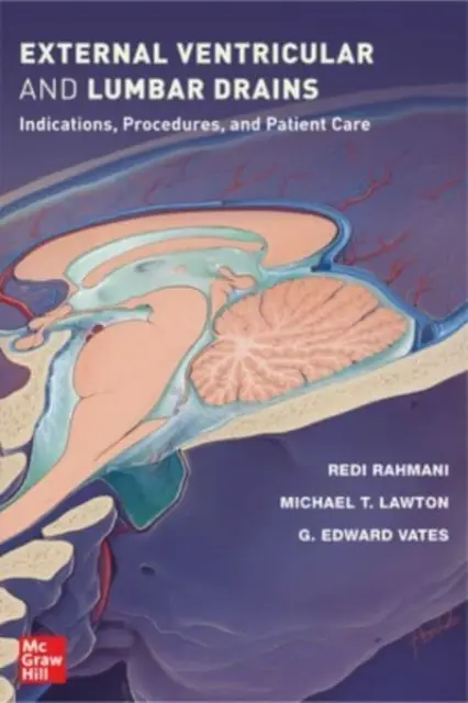 Drenaje ventriculare externe și lombare: Indicații, proceduri și îngrijirea pacienților - External Ventricular and Lumbar Drains: Indications, Procedures, and Patient Care