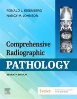 Patologie radiografică comprehensivă - Comprehensive Radiographic Pathology