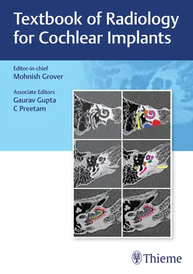 Manual de radiologie pentru implanturile cohleare - Textbook of Radiology for Cochlear Implants