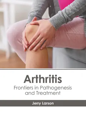 Artrita: Frontiere în patogeneză și tratament - Arthritis: Frontiers in Pathogenesis and Treatment