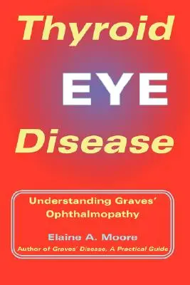 Boala tiroidiană a ochilor: Înțelegerea oftalmopatiei Graves - Thyroid Eye Disease: Understanding Graves' Ophthalmopathy