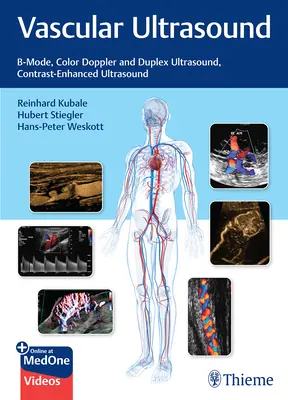 Ecografie vasculară: B-Mode, Doppler color și ecografie duplex, ecografie cu contrast mărit - Vascular Ultrasound: B-Mode, Color Doppler and Duplex Ultrasound, Contrast-Enhanced Ultrasound