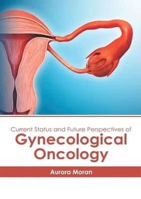 Stadiul actual și perspectivele viitoare ale oncologiei ginecologice - Current Status and Future Perspectives of Gynecological Oncology